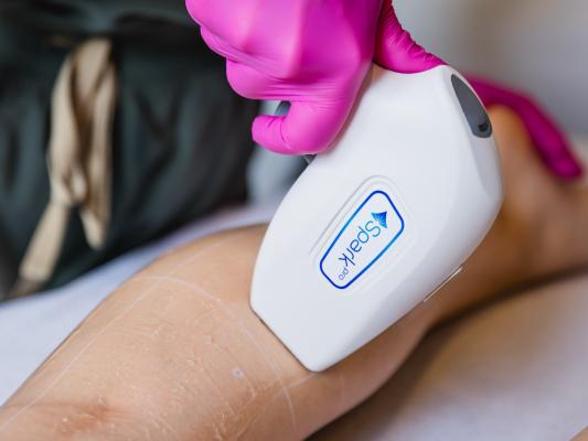 Diodenlaser-Handstück bei der Haarentfernung am Bein in der Praxis H&H trifft Medizin