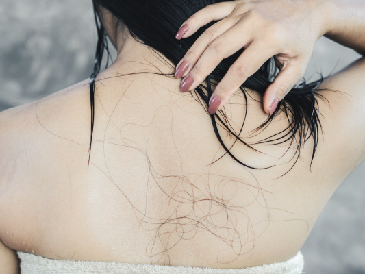 Haarausfall bei Frauen