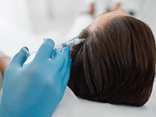 MesoHair Behandlung in Ludwigsburg